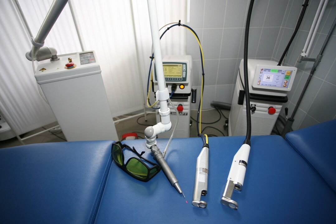 laser equipment for removing warts