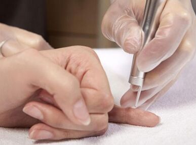 Performing laser therapy